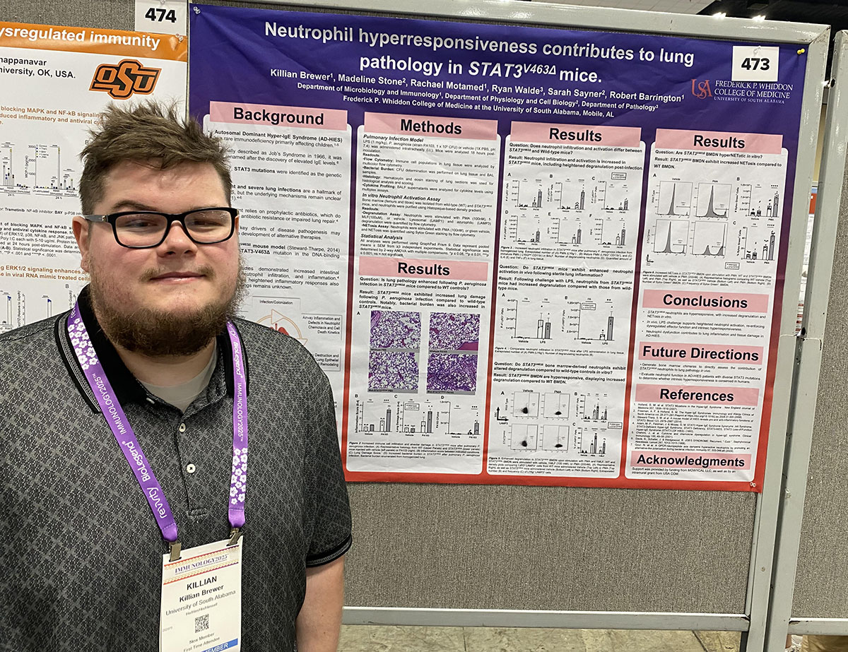 Killian Brewer presents research